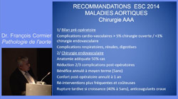 Pathologie de l'aorte thoracique