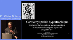 Cardiomyopathie hypertrophique