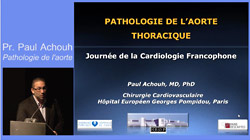 Pathologie de l'aorte thoracique