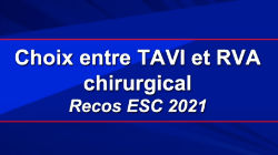 Choix entre TAVI et RVA chirurgical