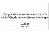 Complications cardiaques de la radiothérapie anticancéreuse thoracique