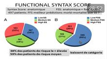 Apport de la FFR dans la décision du traitement des sténoses coronaires