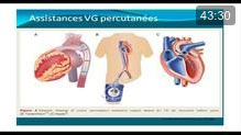 Reperfusion dans l’infarctus du myocarde ST+: cas clinique argumenté selon les recommandations 