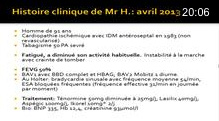 Resynchronisation dans l’insuffisance cardiaque: cas clinique argumenté selon les recommandations.

Jérôme Lacotte, Ghassan Moubarak 