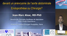 Comment raisonner devant un anvrysme de l'aorte abdominale. Endoprothse ou chirurgie ?