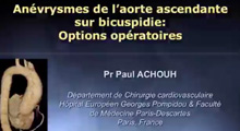 Anvrysmes de l'aorte ascendante sur bicuspidie: Options opratoires et suivi 