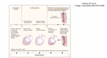 Mort subite du sujet jeune: canalopathies et cardiopathies non ischmiques