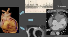 Problmatiques dans les pricardites: illustration par des cas cliniques