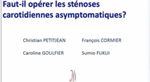 Faut-il encore oprer une stnose carotidienne asymptomatique ?