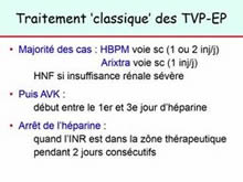 Choix du traitement anticoagulant 