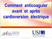 Comment anticoaguler avant et après cardioversion électrique? Simon Abou Jaoudé