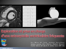 Exploration et prise en charge d’une extrasystolie ventriculaire frquente Jrme Lacotte