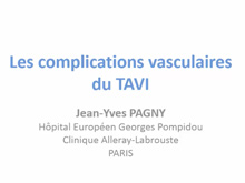 Complications vasculaires des procédures interventionnelles 