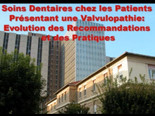 Soins dentaires chez les patients prsentant une valvulopathie: volution des recommandations et des pratiques