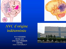 AVC d’origine indtermine Hassan Hosseini