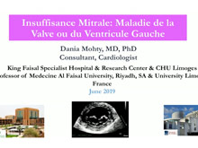 Insuffisance Mitrale : Maladie du muscle ou de la valve? Comment faire le diagnostic en échographie ? Dania Mohty