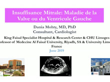 Insuffisance Mitrale : Maladie du muscle ou de la valve? Comment faire le diagnostic en chographie ? Dania Mohty